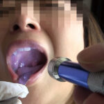 日本女性の性反応調査（4） オーガズムの実態