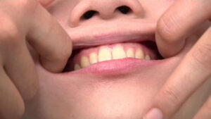 歯観察レズ 安達まどか・日向小夏