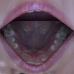 歯フェチ！本物歯科治療映像 安田ななは