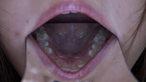 歯フェチ！本物歯科治療映像 安田ななは