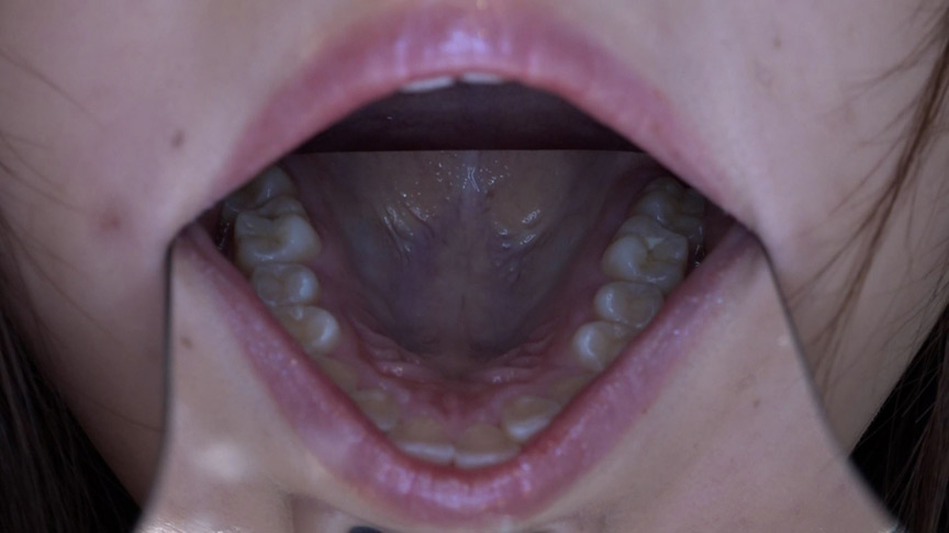 歯フェチ!本物歯科治療映像 安田ななは