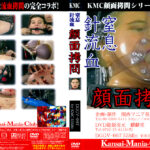 窒息 針流○ 顔面○問