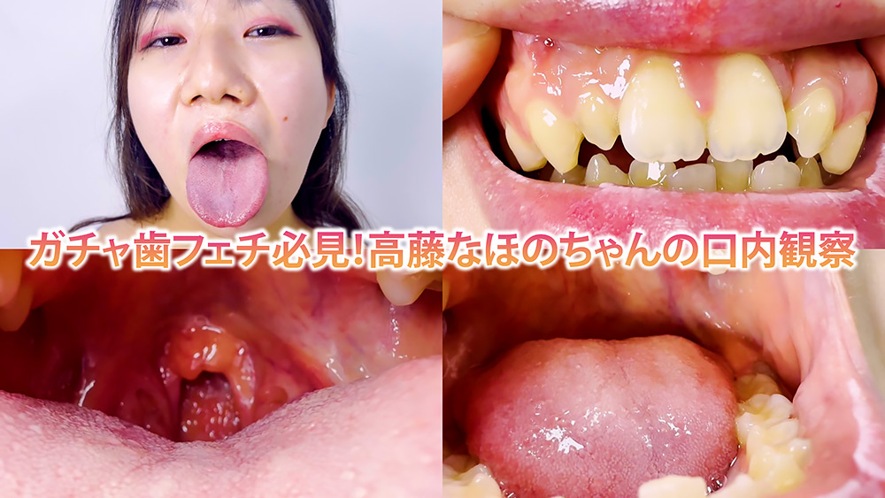 ガチャ歯フェチ必見!高藤なほのちゃんの口内観察